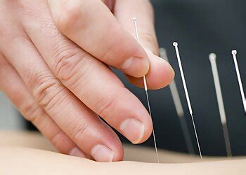 Sydney Acupuncture Treatments .